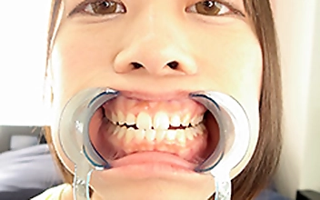 【歯・口内】奈築りおチャンの激レア 歯・口内・舌ベロ激写フェチ映像！！！