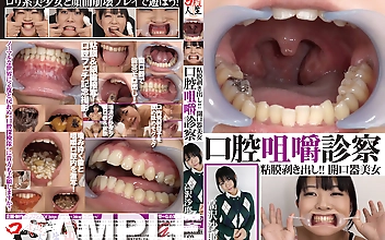 口腔咀嚼診察 粘膜剥き出し！！開口器美女 高沢沙耶