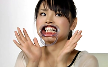 歯14